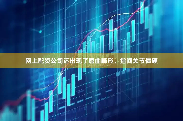 网上配资公司还出现了屈曲畸形、指间关节僵硬