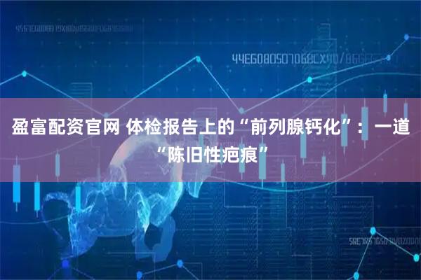 盈富配资官网 体检报告上的“前列腺钙化”:一道“陈旧性疤痕”